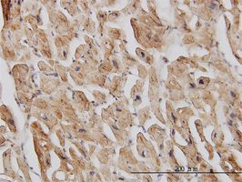 DAP5 antibody (ab54972) used in immunohistochemistry at 3ug/ml on formalin fixed and paraffin embedded human heart.