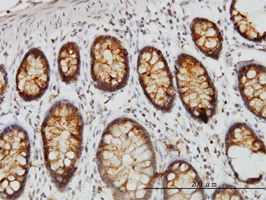 DARS antibody (ab54601) used in immunohistochemistry at 3ug/ml on formalin fixed and paraffin embedded human colon.