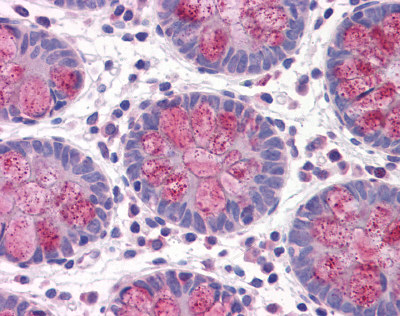 Immunohistochemical analysis of formalin fixed paraffin embedded Human colon tissue using ab115213 at 5 µg/ml