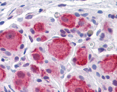 Immunohistochemical analysis of formalin fixed paraffin embedded Human Ganglion cells using ab115213 at 5 µg/ml