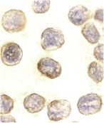 ab2017 at 10µg/ml staining DAXX in Hela cells by ICC/IF