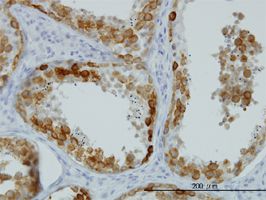 DAZ1 antibody (ab54605) used in immunohistochemistry at 1ug/ml on formalin fixed and paraffin embedded human testis.