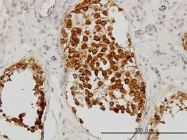 DAZ1 antibody (ab54607) used in immunohistochemistry at 3ug/ml on formalin fixed and paraffin embedded human testis.