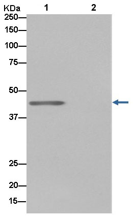 Western blot analysis of DAZAP1 in Jurkat cell lysate immunoprecipitated using ab184183 at 1/50 dilution (Lane 1). Lane 2: PBS instead of Jurkat lysate.Secondary: Anti-Rabbit IgG (HRP), specific to the non-reduced form of IgG at 1/1500 dilution.