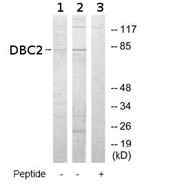 All lanes : Anti-DBC2 antibody (ab69984) at 1/500 dilutionLane 1 : Extracts from HepG2 cells (5-30µg)Lane 2 : Extracts from HeLa cells (5-30µg) Lane 3 : Extracts from HepG2 cells (5-30µg), plus immunising peptide (5-10µg)
