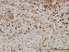 BDF4 antibody (ab56813) used in immunohistochemistry at 3ug/ml on formalin fixed and paraffin embedded human spleen.