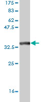 Western blot against tagged recombinant protein immunogen using ab56374 DBPA antibody at 1ug/ml.