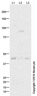 All lanes : Anti-DC-SIGN antibody (ab87375) at 1 µg/mlLane 1 : Jurkat (Human T cell lymphoblast-like cell line) Whole Cell Lysate Lane 2 : THP1 (Human acute monocytic leukemia cell line) Whole Cell Lysate Lane 3 : U937 (Human leukemic monocyte lymphoma cell line) Whole Cell Lysate Lysates/proteins at 10 µg per lane.SecondaryGoat polyclonal to Rabbit IgG - H&L - Pre-Adsorbed (HRP) at 1/3000 dilutiondeveloped using the ECL techniquePerformed under reducing conditions.