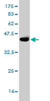 Western blot against tagged recombinant protein immunogen using ab56482 DCAMLK1 antibody at 1ug/ml.