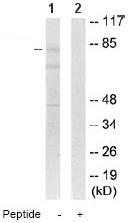 All lanes : Anti-DCAMKL2 antibody (ab64852) at 1/500 dilutionLane 1 : Extracts of HepG2 cellsLane 2 : Extracts of HepG2 cells with immunising peptide at 10 µgLysates/proteins at 30 µg per lane.