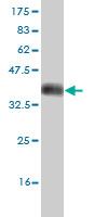Western blot against tagged recombinant protein immunogen using ab58070 DCAMKL2 antibody at 1ug/ml.