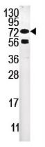 Anti-DCAMKL2 antibody - Aminoterminal end (ab71456) at 1/60 dilution + HeLa cell line lysate at 12.5 µg