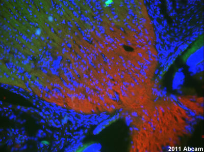 ab45868 staining rat optic nerve sections by IHC-FoFr. The animal was perfused with 4% paraformaldehyde and further post fixed with 4% paraformaldehyde overnight. The tissues were cryoprotected and sectioned using a cryostat. Staining with ab45868 at a 1/200 dilution in 0.3% TritonX with 0.1x PBS in 10% donkey serum was performed for 1h at 24°C. A donkey anti-goat Alexa488 polyclonal antibody at 1/1000 was used as the secondary antibody. β III tubulin can be observed in red (Alexa fluro 568 secondary). DCDC2 is expressed in the optic nerve.See Abreview