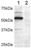 All lanes : Anti-DCDC2 antibody (ab45868) at 0.2 µg/mlLane 1 : COS7 cell lysate transfected with full length recombinant human DCDC2Lane 2 : Untransfected control COS7 cells