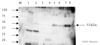 All lanes : Anti-DCDC2 antibody (ab45868) at 1/500 dilutionLane 1 : adult mouse heartLane 2 : adult mouse brainLane 3 : three-month old mouse brainLane 4 : 5 week old mouse brainLane 5 : mouse hippcampus including dentate gyrusLane 6 : mouse DRGLane 7 : primary mouse neuronal cultureLane 8 : mouse astrocyte cultureLysates/proteins at 20 µg per lane.SecondaryDAKO cytomation Conjugation: HRPdeveloped using the ECL techniquePerformed under reducing conditions.