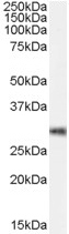 ab53549 antibody (0.1µg/ml) staining of DCDC2 in Mouse Brain lysate (35µg protein in RIPA buffer)