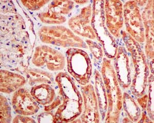 Immunohistochemical analysis of paraffin-embedded Human kidney tissue labeling DCDC2 with ab157186 at 1/250 dilution.