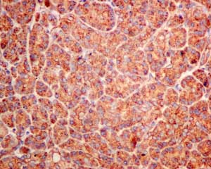 Immunohistochemical analysis of paraffin-embedded Human pancreas tissue labeling DCDC2 with ab157186 at 1/250 dilution.