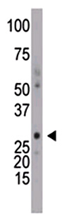 Anti-DCK antibody (ab38012) at 1/100 dilution + Mouse intestine tissue lysatePerformed under reducing conditions.