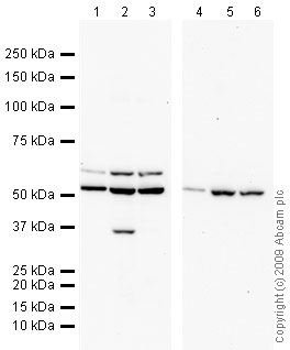 All lanes : Anti-Dcp2 antibody (ab28658) at 1 µg/mlLane 1 : HeLa (Human epithelial carcinoma cell line) Whole Cell Lysate Lane 2 : Jurkat (Human T cell lymphoblast-like cell line) Whole Cell Lysate Lane 3 : HEK293 (Human embryonic kidney cell line) Whole Cell Lysate Lane 4 : HeLa (Human epithelial carcinoma cell line) Whole Cell Lysate with Human Dcp2 peptide (ab30458) at 1 µg/mlLane 5 : Jurkat (Human T cell lymphoblast-like cell line) Whole Cell Lysate with Human Dcp2 peptide (ab30458) at 1 µg/mlLane 6 : HEK293 (Human embryonic kidney cell line) Whole Cell Lysate with Human Dcp2 peptide (ab30458) at 1 µg/mlLysates/proteins at 10 µg per lane.SecondaryGoat polyclonal to Rabbit IgG - H&L - Pre-Adsorbed (HRP) at 1/3000 dilutionPerformed under reducing conditions.