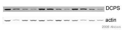 All lanes : Anti-DCPS antibody (ab57314) at 1/200 dilutionLane 1 : Whole cell lysate prepared from mouse neuroblastomaLane 12 : Whole cell lysate prepared from mouse neuroblastomaLysates/proteins at 10 µg per lane.SecondaryAlexa Fluor® 680 conjugated donkey polyclonal to mouse IgPerformed under reducing conditions.