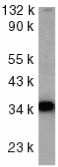 Anti-DcR2 antibody (ab2019) at 1/1000 dilution + HeLa whole cell lysateObserved band size : 35 kDa (why is the actual band size different from the predicted?)
