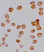 ab2019 at 10µg/ml staining DcR2 in human Hela cells by Immunocytochemistry.