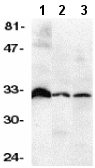 All lanes : Anti-DcR3 antibody (ab8405) at 1/500 dilutionLane 1 : Human heart tissue lysateLane 2 : Human brain tissue lysateLane 3 : Human kidney tissue lysateObserved band size : 33 kDa (why is the actual band size different from the predicted?)