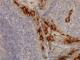 DcR3 antibody (ab57956) used in immunohistochemistry at 3ug/ml on formalin fixed and paraffin embedded human tonsil.
