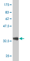 Western blot against tagged recombinant protein immunogen using ab54737 DCTD antibody at 1ug/ml.