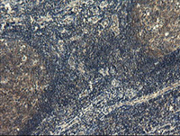 ab128111, at 1/150 dilution, staining COMMD1/MURR1 in paraffin-embedded Human tonsil tissue by Immunohistochemistry