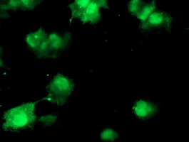 ab128111, at 1/100 dilution, staining COMMD1/MURR1 in COS7 cells transiently transfected with pCMV6-ENTRY COMMD1/MURR1 by Immunofluorescence.