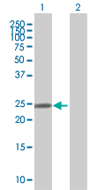 All lanes : Anti-DCTN6 antibody (ab67777) at 1/500 dilutionLane 1 : DCTN6 transfected 293T cell lysateLane 2 : Non transfected 293T cell lysateLysates/proteins at 25 µg per lane.SecondaryGoat Anti-Mouse IgG (H&L)-HRP conjugated at 1/2500 dilution