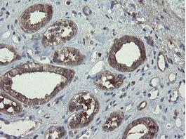 Immunohistochemical analysis of paraffin embedded Human kidney tissue labelling COMMD1/MURR1 with ab131597 at a 1/150 dilution.
