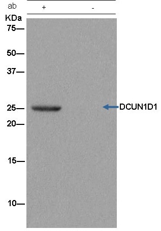 Immunoprecipitation analysis of HeLa cells labeling DCUN1D1 using ab181233 at 1/50 dilution. A Goat Anti-Rabbit IgG (HRP), specific to the non-reduced form of IgG was used as secondary antibody at a 1/1500 dilution.