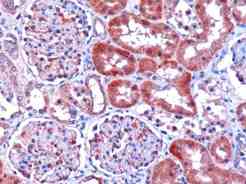 Ab11800 (1ug/ml) staining human DCXR in human kidney by immunohistochemistry using paraffin embedded tissue. Microwaved antigen retrieval with citrate buffer, pH6, HRP-staining.