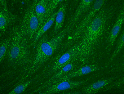 Immunocytochemistry image of ab110283 stained Human HDFn cells. The cells were paraformaldehyde fixed (4%, 20 min) and Triton X-100 permeabilized (0.1%, 15min). The cells were incubated with ab110283 at 4 µg/ml for 2h at room temperature or over night at 4°C. The secondary antibody was (green) AlexaFluor® 488 goat anti-mouse IgG (H+L) used at a 1/1000 dilution for 1h. 10% Goat serum was used as the blocking agent for all blocking steps. DAPI was used to stain the cell nuclei (blue). Target protein locates mainly in the cell membrane.
