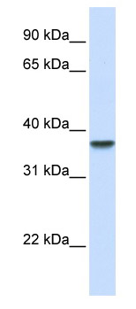 Anti-DDAH1 antibody (ab82908) at 1 µg/ml (5% skim milk / PBS buffer) + fetal liver lysate at 10 µgSecondaryHRP conjugated anti-Rabbit IgG at 1/50000 dilution