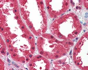 Immunohistochemistry (Formalin/PFA-fixed paraffin-embedded sections) analysis of human kidney tissue labelling DDAH1 with ab82908 at 2.5 µg/ml.