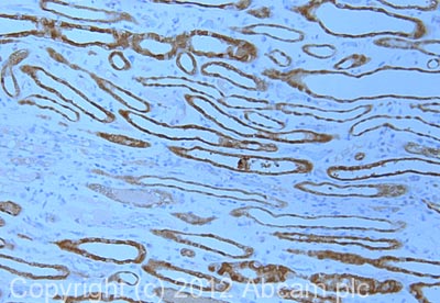 IHC image of DDAH1 staining in human kidney formalin fixed paraffin embedded tissue section, performed on a Leica BondTM system using the standard protocol F. The section was pre-treated using heat mediated antigen retrieval with sodium citrate buffer (pH6, epitope retrieval solution 1) for 20 mins. The section was then incubated with ab108088, 1µg/ml, for 15 mins at room temperature and detected using an HRP conjugated compact polymer system. DAB was used as the chromogen. The section was then counterstained with haematoxylin and mounted with DPX. For other IHC staining systems (automated and non-automated) customers should optimize variable parameters such as antigen retrieval conditions, primary antibody concentration and antibody incubation times.