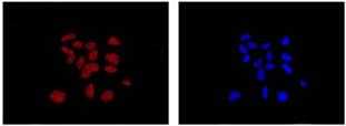 Immunofluorescence analysis of 293 cells (fixative 4% paraformaldehyde) labeling DDAH1 with ab180599 at a 1/100 dilution (left image), and counterstained with Dapi (right image). Goat anti rabbit IgG (Dylight 555) secondary used at a 1/200 diution.