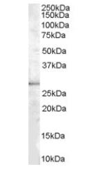 Anti-DDAH2 antibody (ab1383) at 1 µg/ml + Human Heart extracts at 35 µg