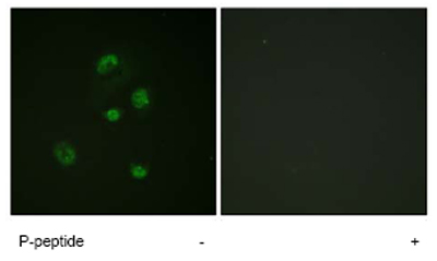 Immunofluorescence analysis of A549 cells, using ab63392 at 1:500 dilution.Left image untreated.Right image treated with phospho peptide.