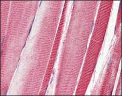 ab63337 at 1/1000 dilution staining DDR2 in human skeletal muscle tissue section by Immunohistochemistry (Formalin/ PFA-fixed paraffin-embedded tissue sections).