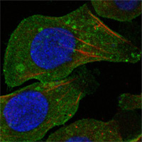 ab63337 at 1/1000 dilution staining DDR2 in human A549 cells by Immunocytochemistry/ Immunofluorescence. An Alexa Fluor® conjugated Goat anti-mouse was used as secondary. The actin filaments were labeled red with DY-554 phalloidin whilst nuclei were stained blue with DRAQ5 fluorescent DNA dye.