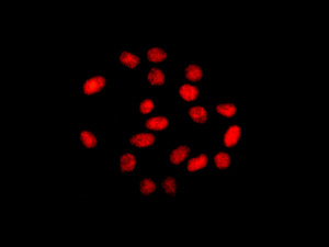 Immunofluorescent analysis of 293T cells labeling DDX17 with ab180190 at 1/100.