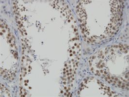 DDX26 antibody (ab57069) used in immunohistochemistry at 3ug/ml on formalin fixed and paraffin embedded human testis.