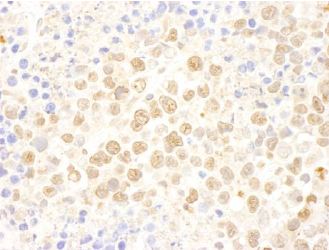 Formalin-fixed, paraffin-embedded section of mouse teratoma. Antibody: ab113259 used at a dilution of 1/500. Detection: DAB staining.