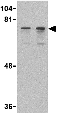 Lane 1 :  Anti-DDX3 antibody (ab37160) at 0.5 µg/mlLane 2 :  Anti-DDX3 antibody (ab37160) at 1 µg/mlLane 1 : Human HepG2 cell lysateLane 2 : Human HepG2 cell lysateLysates/proteins at 15 µg per lane.
