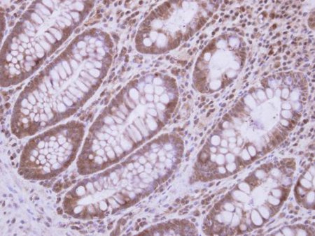 Immunohistochemical analysis of paraffin embedded Human colon tissue labeling DDX3 with ab151965 at a 1/250 dilution.